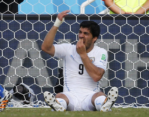 Uruguay's Luis Suarez holds his teeth during the 2014 World Cup Group D soccer match between Uruguay and Italy at the Dunas arena in Natal June 24, 2014. Suarez can learn to stop biting opponents but it will not be a quick or easy process, senior psychologists have said following the Uruguay striker's bite on the shoulder of Italy defender Giorgio Chiellini at the World Cup. Suarez, twice previously banned for biting, is under investigation by FIFA for the incident late in the Group D clash on Tuesday and faces another lengthy suspension. REUTERS