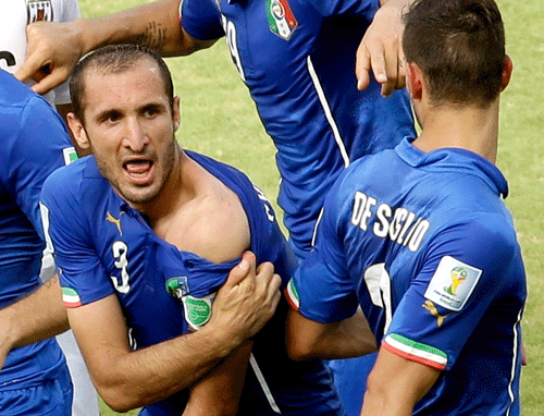 Italy's Giorgio Chiellini displays his shoulder showing apparent teeth marks after colliding with the mouth of Uruguay's Luis Suarez during the group D World Cup soccer match between Italy and Uruguay at the Arena das Dunas in Natal, Brazil, Tuesday, June 24, 2014. AP