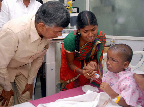 AP Chief Minister N Chandra Babu Naidu meets an injured child of a bus accident in Medak, AP on Friday. PTI Photo