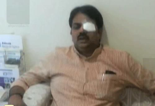 Maharashtra cooperation minister Harshavardhan Patil today suffered an eye injury after some activists from Dhangar community threw ink at him at a function at Bhigwan in Indapur tehsil of Pune district. TV grab