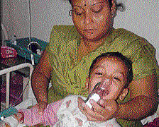 Two year Utkarsh Singh  undergoes treatment in an  Hospital in New Delhi on Saturday.