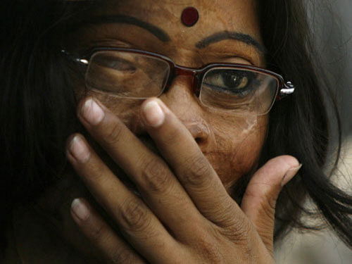 Acid attack victims opened a coffee shop-cum-hangout area Sunday for activists, supporters and civil society members on Fatehabad Road, close to the Taj Mahal. An acid attack survivor attends a conference in Dhaka. Reuters file photo. For representation purpose