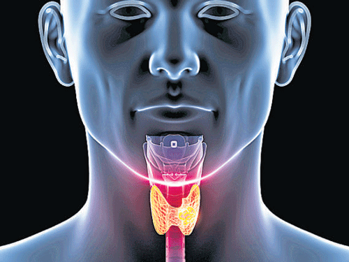 To the shock of many cancer experts, the most common cancer now in South Korea is thyroid cancer, whose incidence has increased fifteenfold in the past two decades.  DH Photo