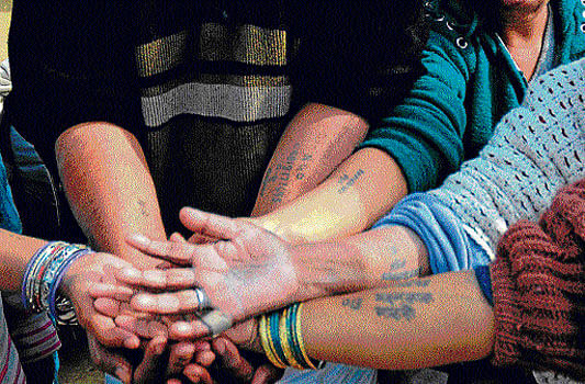 Inhabitants of the rescue centre show their tattooed arms having the NGO's mobile number. DH Photo