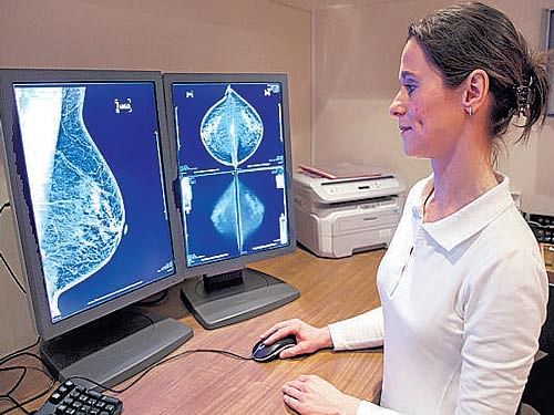 A radiology technician examines mammography images.
