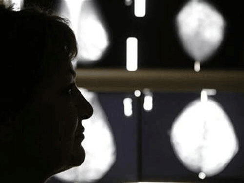 Lung cancer has surpassed breast cancer as the leading cause of cancer death in females in developed countries and the change reflects the tobacco epidemic in women, according to a report released Wednesday by the American Cancer Society and the International Agency for Research on Cancer (IARC). Reuters file photo. For representation purpose