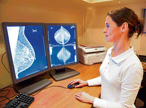 OTHER METHODS There is need for an alternative breast imaging modality.