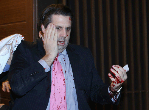 U.S. ambassador to South Korea Mark Lippert leaves after he was slashed in the face by an unidentified assailant at a public forum in central Seoul. Reuters photo