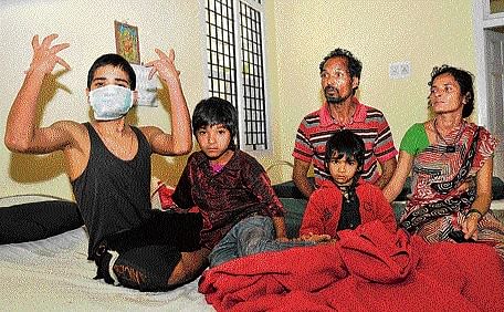 Seetharam explains about the incident, at a ward in KR Hospital in  Mysuru on Wednesday, as his parents and siblings look on. DH Photo