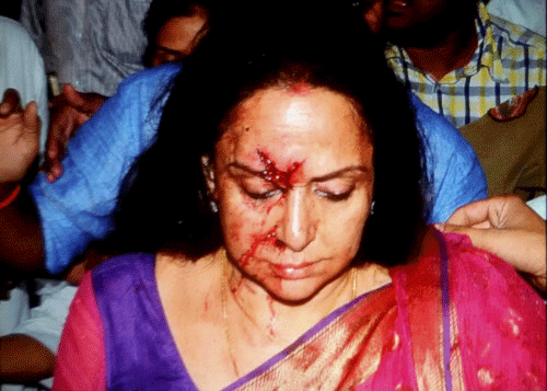 Veteran actress and BJP MP Hema Malini being rushed to a hospital in Jaipur on Thursday after being injured in a road accident in Dausa. PTI Photo