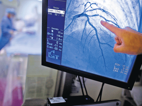 Alternatives: A cardiologist shows the blocked arteries of a patient who had a right and left catheterisation procedure. Cardiologists often treat those suffering from stable angina by opening arteries with stents, but there is an argument that drug therapy may be more effective. NYT