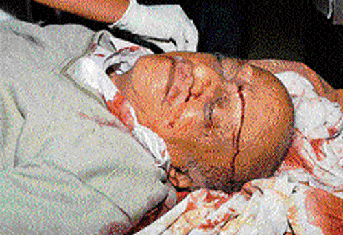 Prof M M Kalburgi was shot in his forehead at his residence at Kalyan Nagar in Dharwad on Sunday. DH Photo