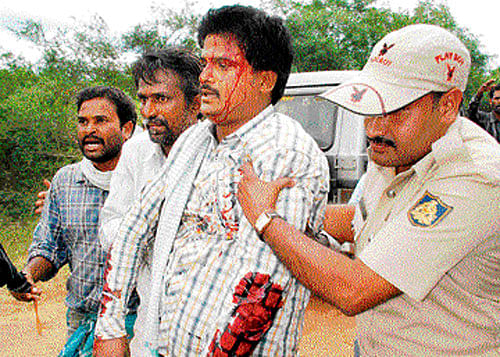 Narendra, who was injured in the tiger attack, at Hadanaru village of H D Kote taluk in Mysuru on Tuesday. DH Photos