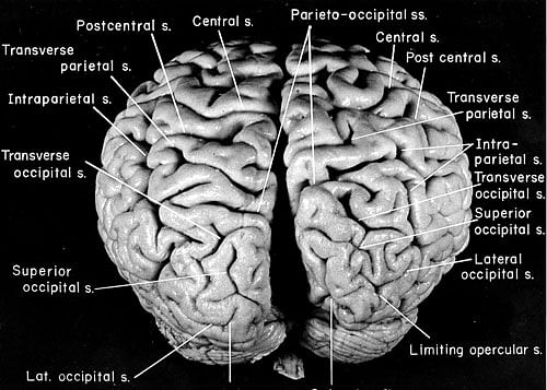 A picture of Albert Einstein's brain with morphological features marked.