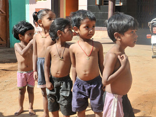 Releasing research paper on stunting, the UN agency said that child malnutrition rates in India are among the highest in the world, with nearly one-half of all children under three years of age being underweight or stunted (lesser height for age).  DH File Photo for representation.