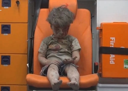 A still image from a video posted on social media shows a boy with bloodied face sitting in an ambulance, after an airstrike. Reuters Photo