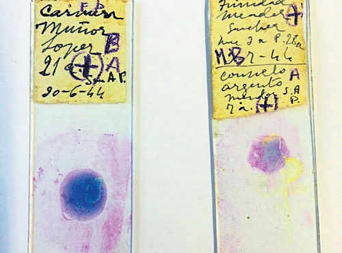 FINDING TRACES In an undated handout photo, slides which were used to diagnose malaria patients in Spain's Ebro delta in the 1940s. PHOTO COURTESY: CARLES LALUEZA-FOX VIA NYT