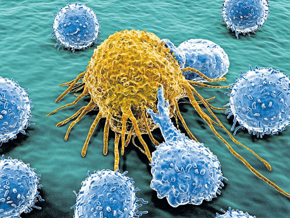 STRONGER RESULTS Tumour-infiltrating lymphocytes are being studied by researchers to enhance their ability to fight cancer. REPRESENTATIVE IMAGE