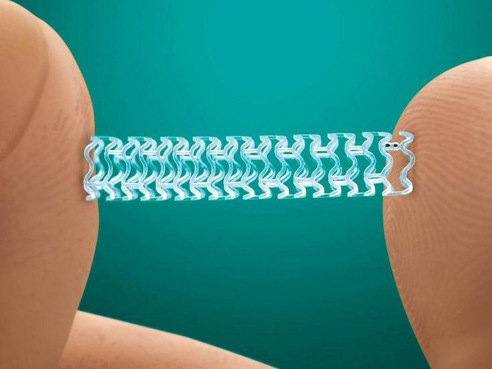 Coronary stents get cheaper by up to 85%.