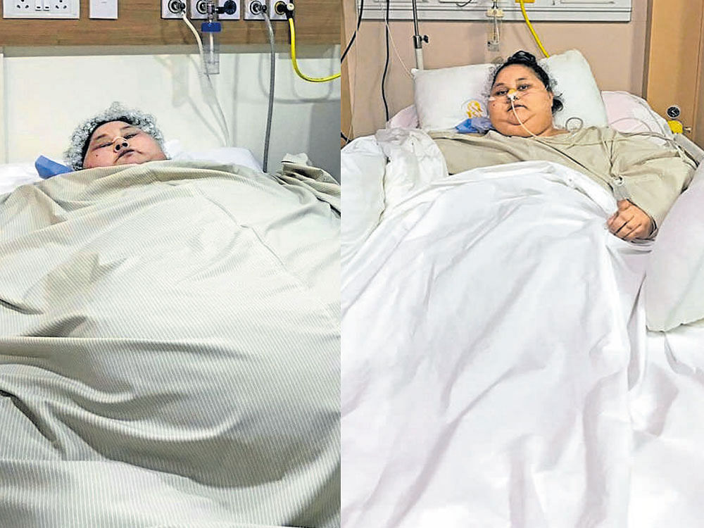 Egyptian Eman Ahmed Abd El Aty lies in a bed at the Saifee Hospital in Mumbai on Saturday after a bariatric surgery. At 500 kg, Eman was believed to be the world's heaviest woman and shed over 100 kg through the surgery. Eman had not left her house in Egypt in over two decades until arriving in Mumbai for the surgery last month.