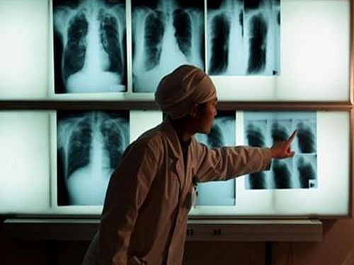 The global targets seek to reduce TB mortality by 90 per cent and incidence by 80 per cent by 2030. Reuters File Photo