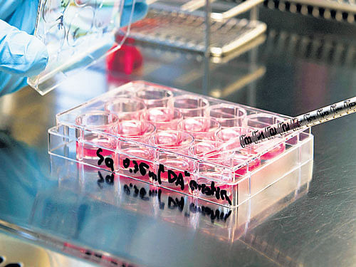 Cell count for both monocytic cells and neutrophils - signs of inflammation - were significantly reduced after MSC therapy, researchers said. File Photo