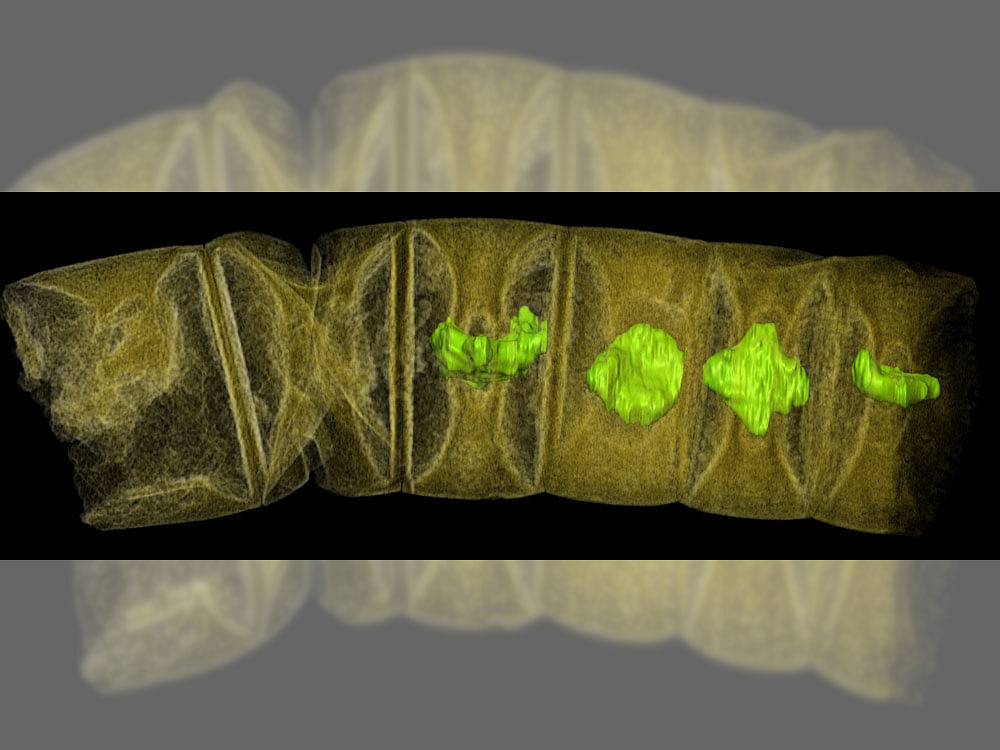 NEW DISCOVERY: A false-colour X-ray image of what could be the oldest-known fossil of red algae. PHOTO CREDIT: Stefan Bengtson