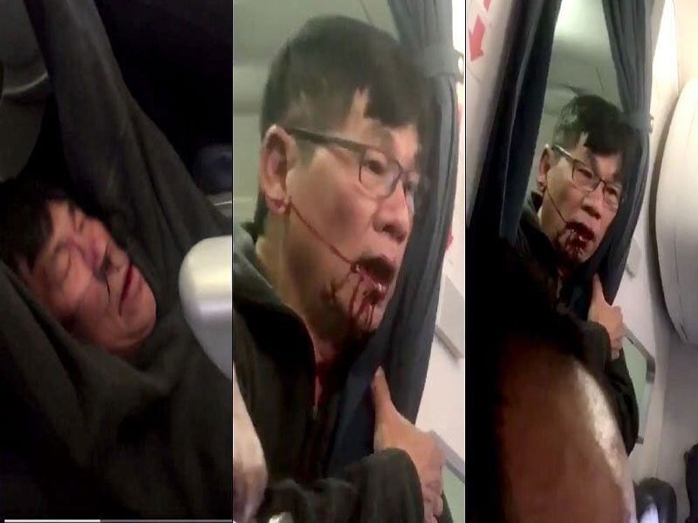 In images now seen around the world, a passenger was forcefully removed and bloodied in the process -- the entire event captured on video by passengers and posted on social media. The 69-year-old passenger, Dr. David Dao, had refused to be bumped from the overbooked flight -- an airline practice that has come under increased scrutiny since the incident. Picture courtesy Twitter