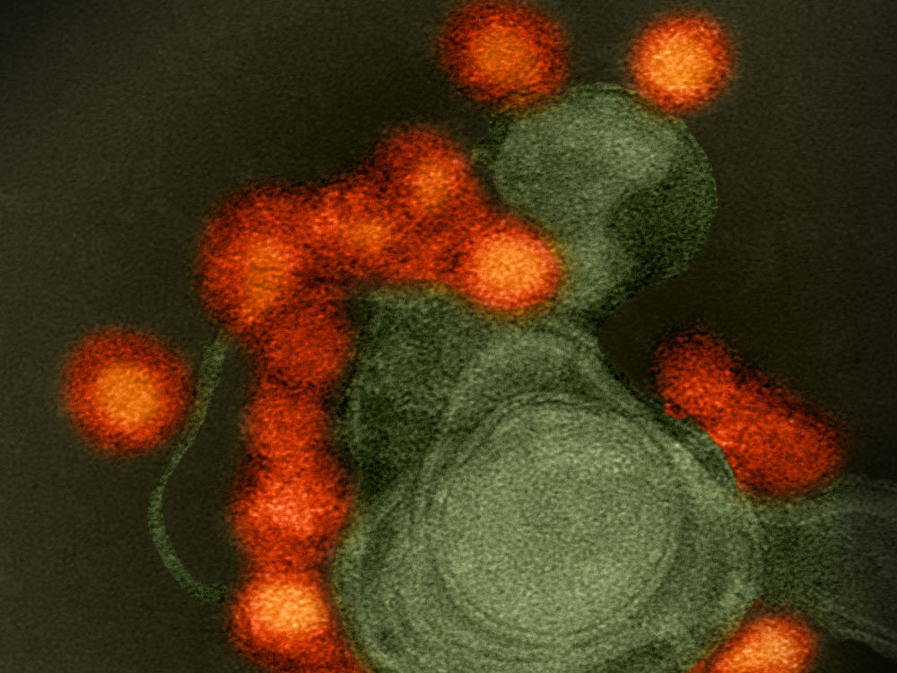 Transmission electron microscope image of negative-stained, Fortaleza-strain Zika virus (red), isolated from a microcephaly case in Brazil. The virus is associated with cellular membranes in the center. Credit: NIAID. Via medicalxpress.com