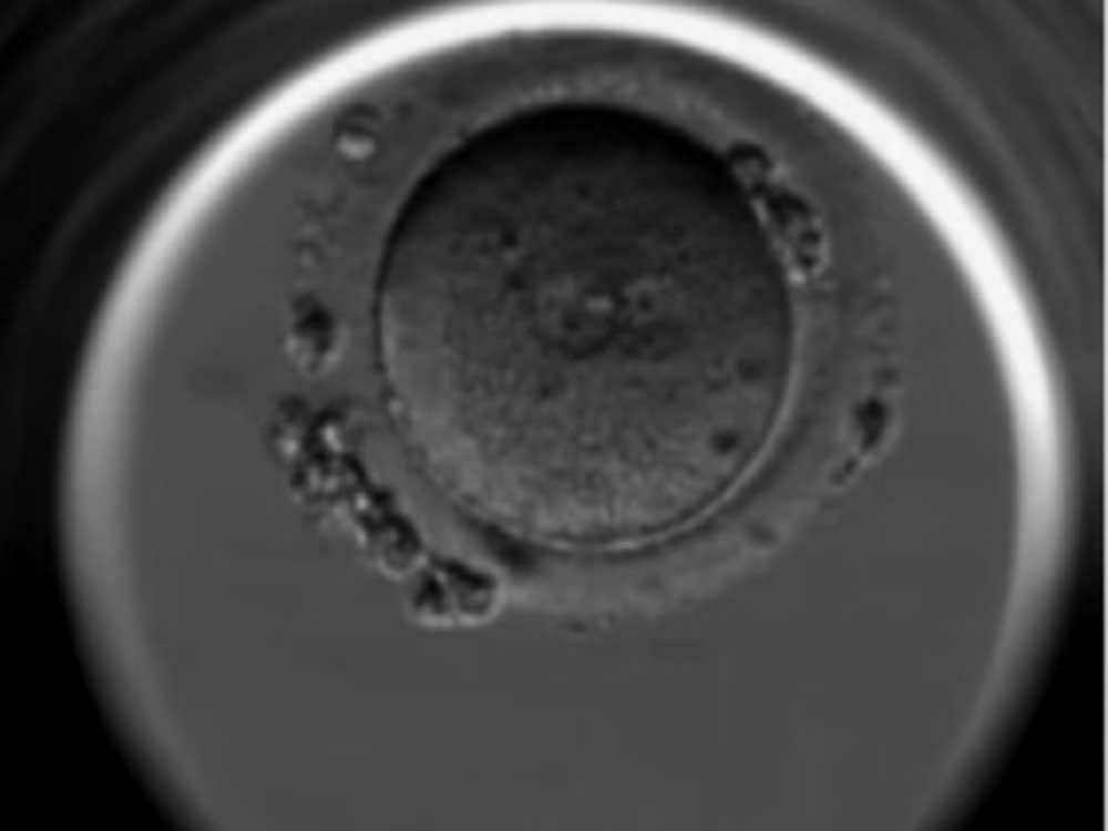 At present embryologists are employed to choose those fertilised eggs that are most likely to result in a pregnancy. This involves checking them by eye to see which appear to be healthy. Screengrab