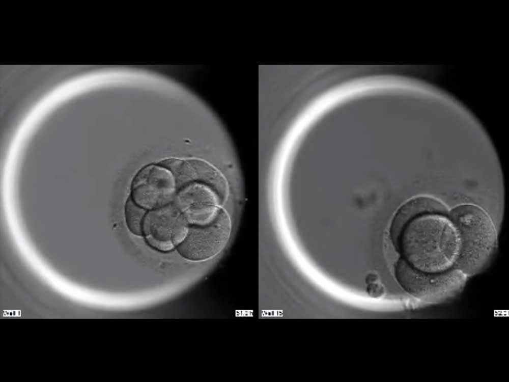 Time-lapse videos showing the first five days of embryo development. The embryo on the left is unedited, whereas the right has been edited to prevent it producing the OCT4 protein. The unedited embryo forms a stable structure called a 'blastocyst' but the edited embryo does not, showing that OCT4 is essential for blastocyst development. (Credit: Dr Kathy Niakan/Nature)