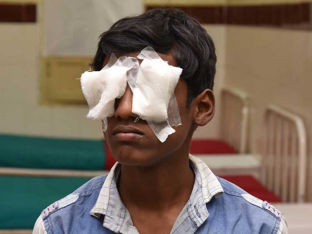 A boy admitted to Minto Eye Hospital with eye injuries caused by fire crackers. DH Photo