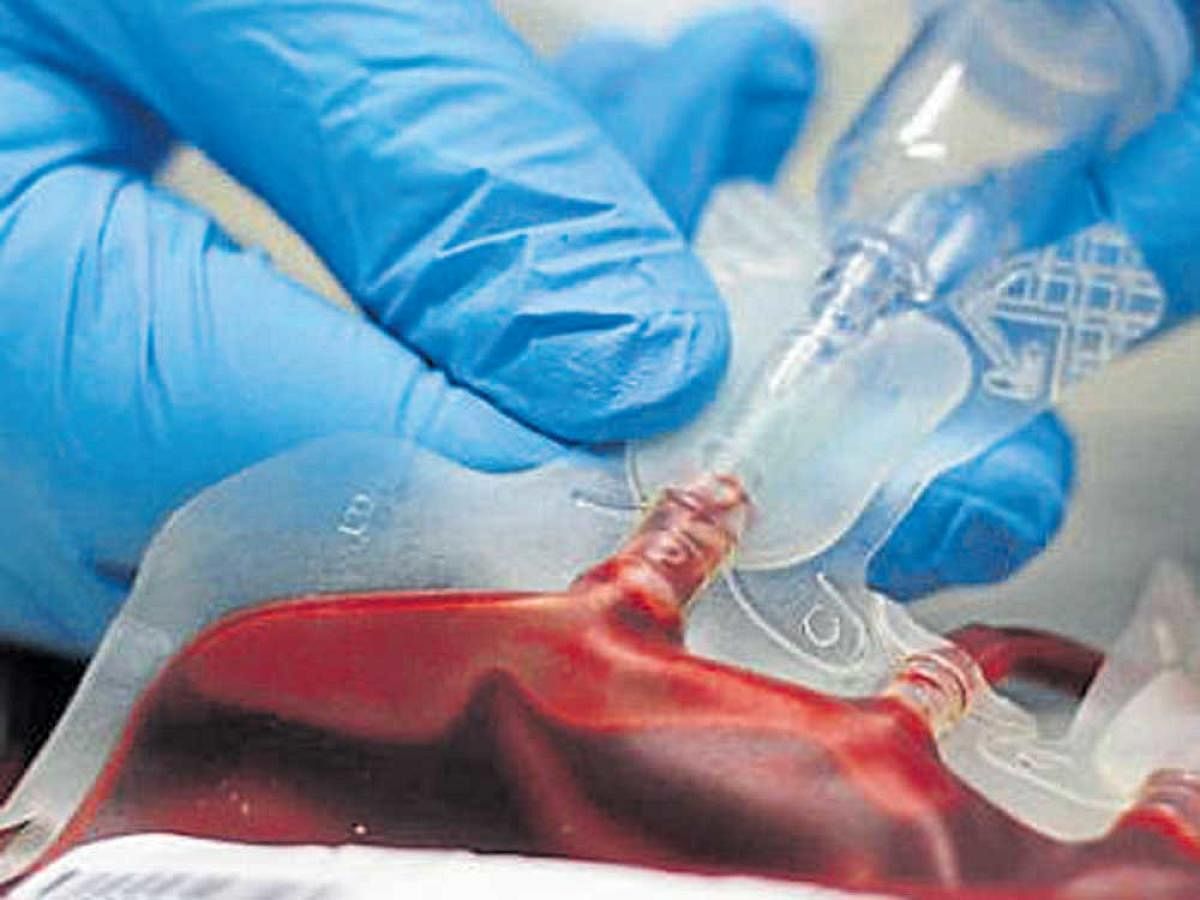 Transfusing blood of young adults could reverse Alzheimer's, allowing the affected to work on their own. Representative image.