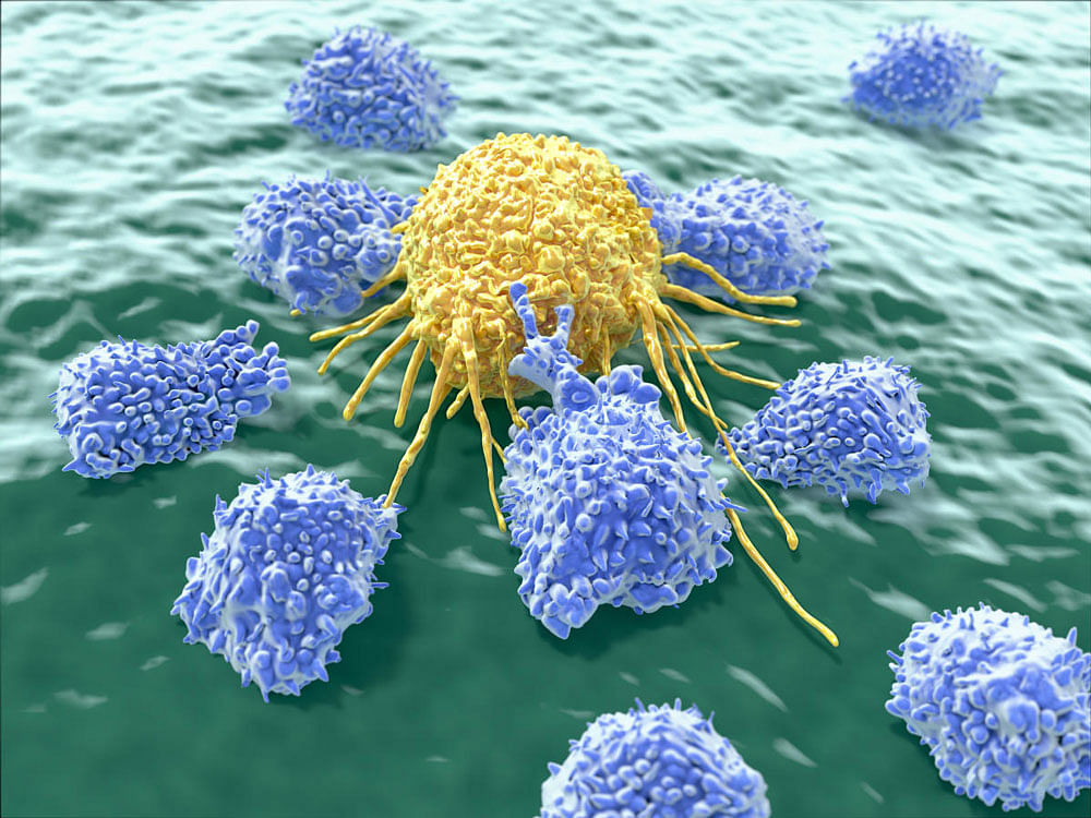 For tumours to grow and spread, cancer cells must make larger than normal amounts of nucleic acids and protein, so they can replicate themselves. Representational Image