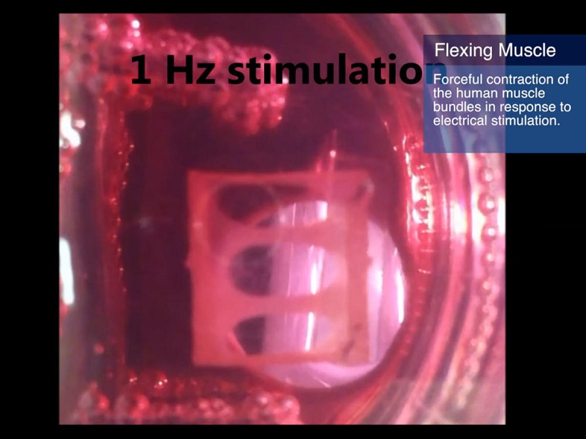 'First functioning human muscle grown from skin cells'