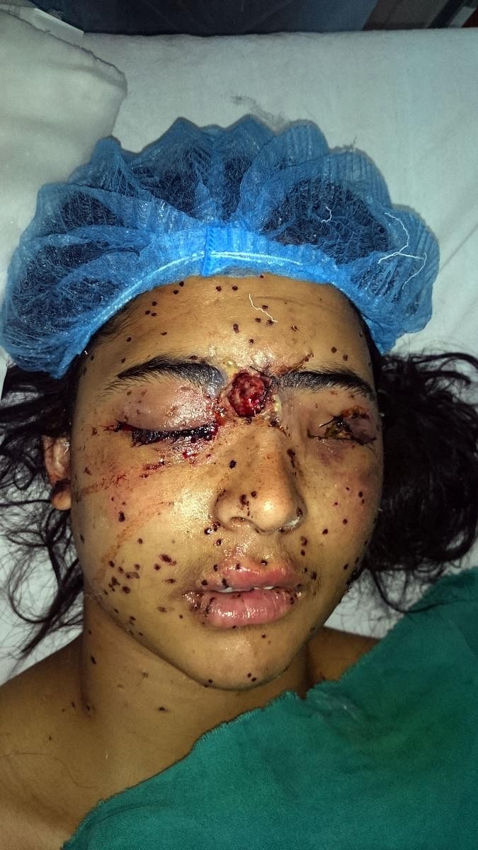 Insha Mushtaq who was blinded by pellets