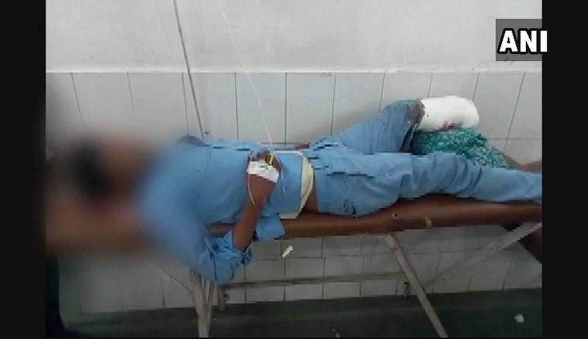 A man's leg, which got severed in a bus accident, was allegedly used as a pillow to prop him up at the state-run Maharani Laxmibai Medical College here, prompting the Uttar Pradesh government to suspend four staff and order a departmental probe into it. Picture courtesy ANI