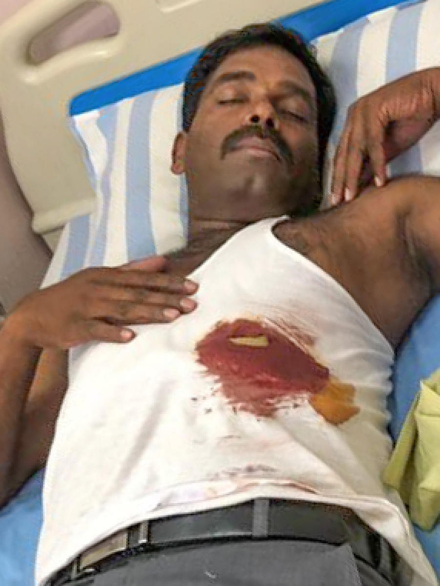 Two accused in the Bellandur woman abduction case, Shankar (25) and Selva Kumar, both native of Dharmapuri, were shot at, in their legs, when they attacked a constable Mahantesh and escape from police custody in the early hours of Monday.