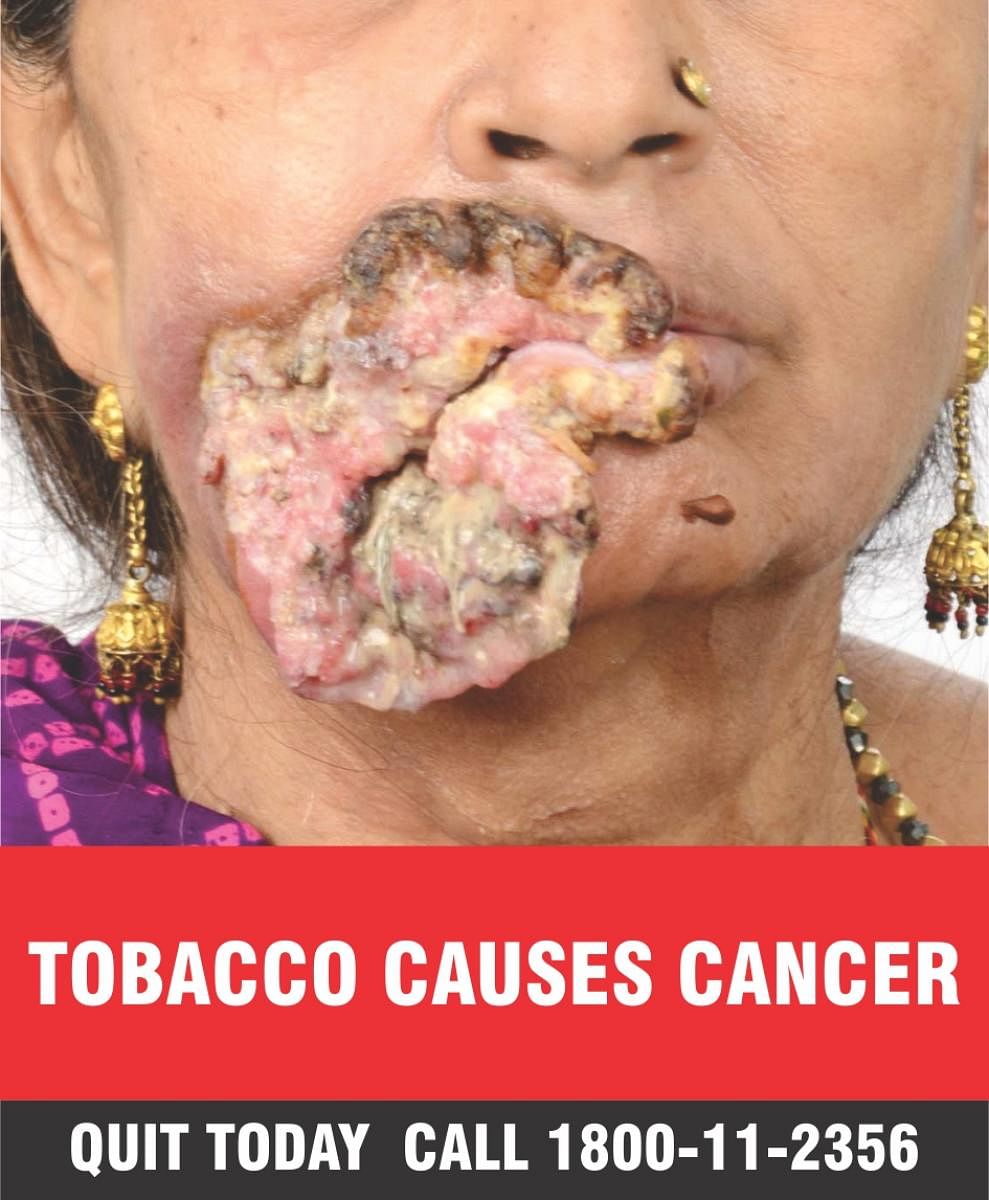 New tobacco warning pictures come into effect from Sept 1