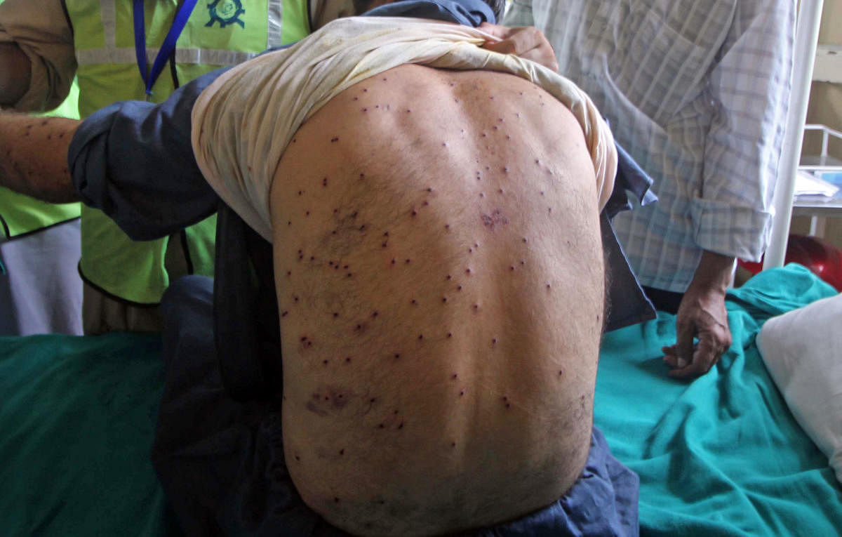 Pellets pierced into the back of a boy