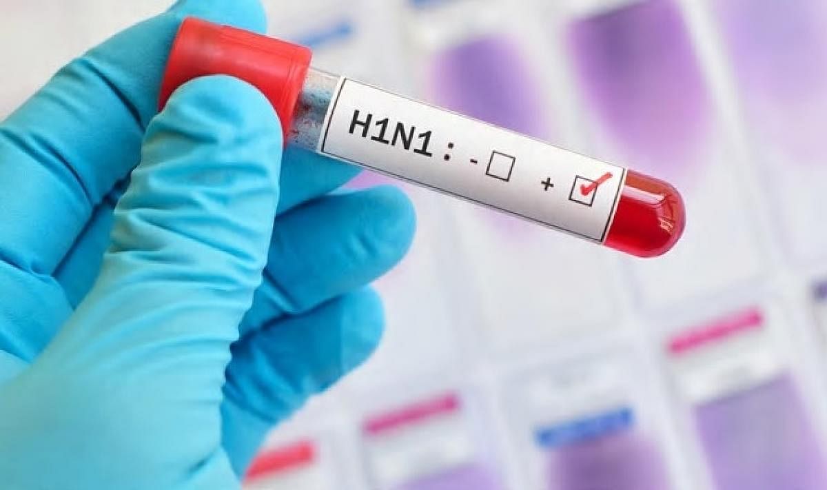 This is the first swine flu death in Meghalaya in 2018. Swine flu had claimed its first victim in Meghalaya in 2009, health officials said on Monday. (Image for representation)