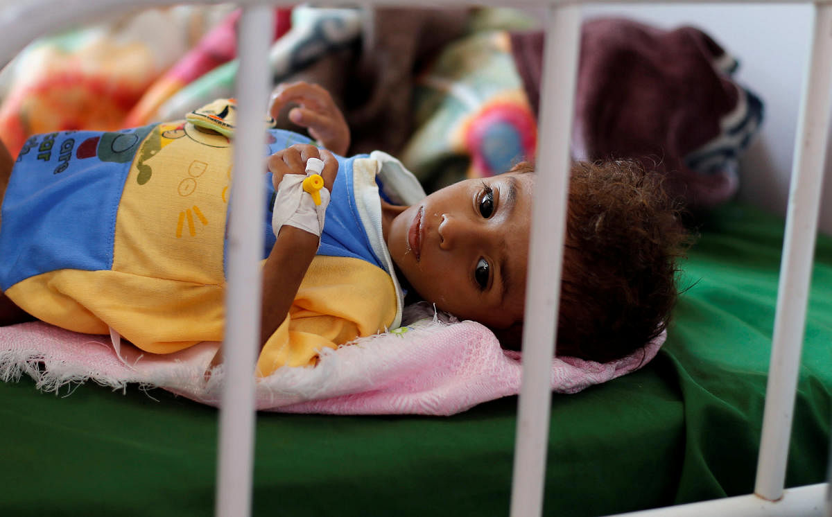 A malnourished boy lies on a bed at a malnutrition treatment center in Sanaa, Yemen. (Reuters File Photo)