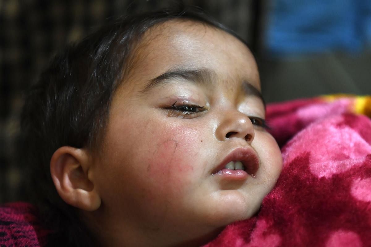 Hiba was playing inside her house in Shopian when clashes broke out between protesters and security forces in the wake of an encounter where six militants were killed on Sunday, the infant's mother Marsala Jan said. AFP Photo 