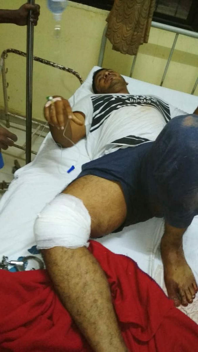The Cubbon Park police opened fire on a 30-year-old rowdy sheeter while he attacked policemen after he jumped out of the police vehicle while he was being escorted to Cubbon Park police station in the wee hours of Tuesday. The rowdy identified as Mujahidu