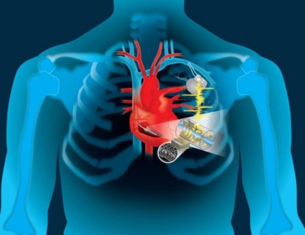 According to the researchers from Duke University in the US, the method has potential as a non-invasive, non-toxic alternative to stress echocardiograms, catheterisations and stress nuclear exams in diagnosing disease.