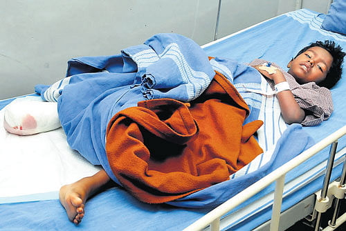 CRUEL TWIST OF FATE Five-year-old Chandan is being treated at Hosmat Hospital after his right foot was amputated on Thursday. DH photo