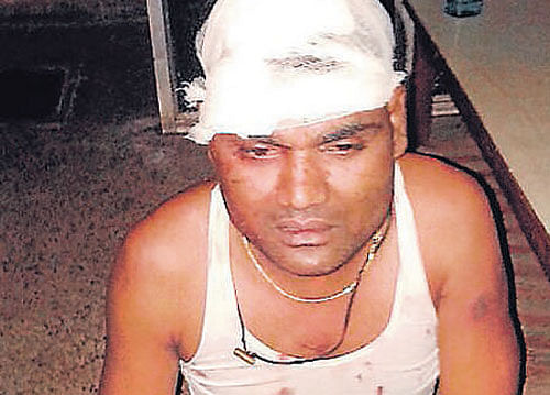 An injured worker at a local hospital in Bhilai, Chhattisgarh, on Thursday. PTI  Photo