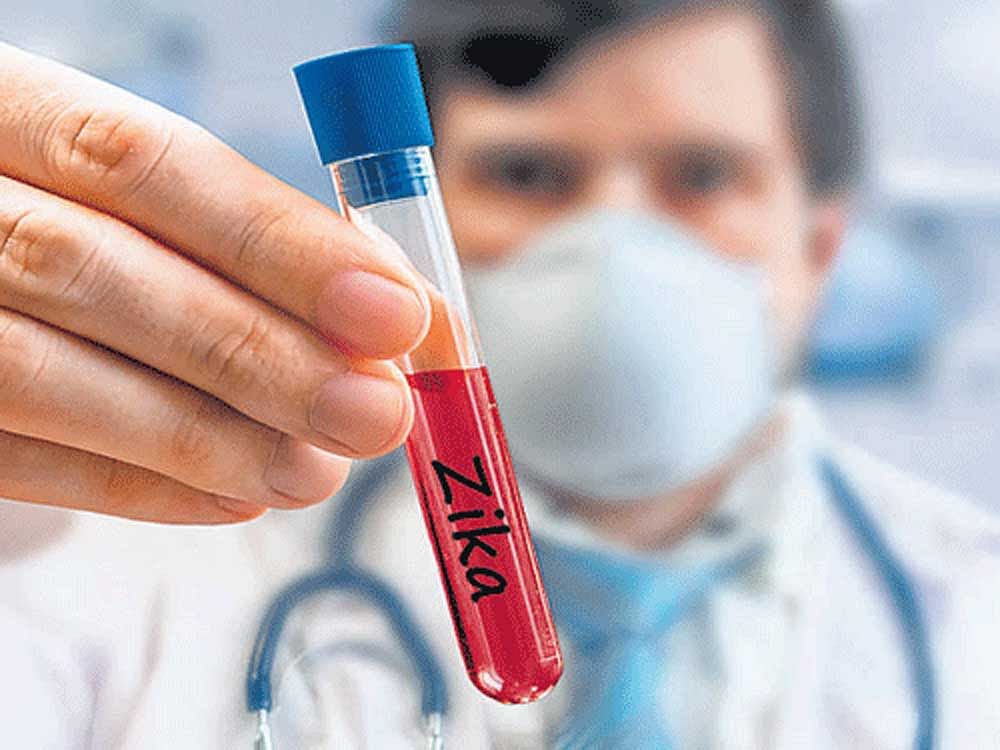 Zika virus strain isolated from Rajasthan matches with the Brazilian Zika strain. Pune-based National Institute of Virology has initiated animal studies to understand the potential of this virus to cause microcephaly.