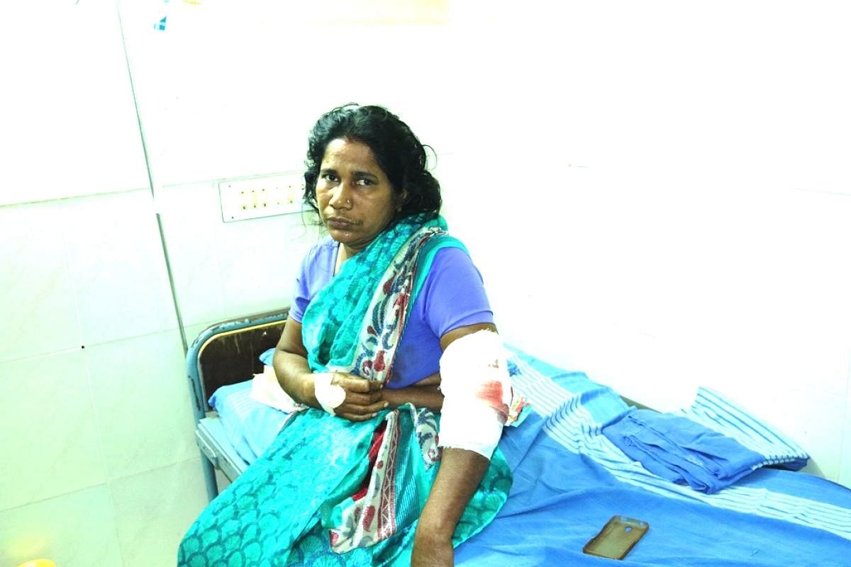 Kanaka Poojary (45) suffered dog bites on her hands and arm when she attempted to chase away the stray dogs attacking her grandchildren in Kandlur on Thursday.