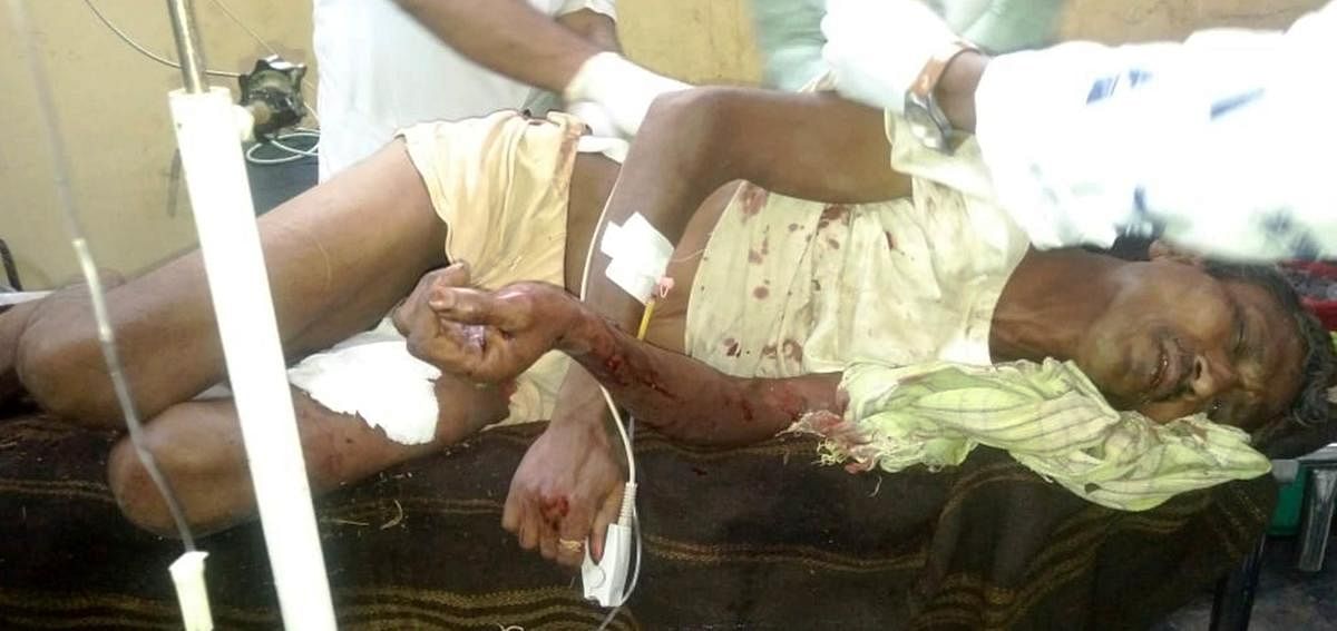 Farmer Namdev Palkar, who has sustained multiple bite wounds in bear attack near Khanapur, is being treated at the district hospital in Belagavi on Tuesday.